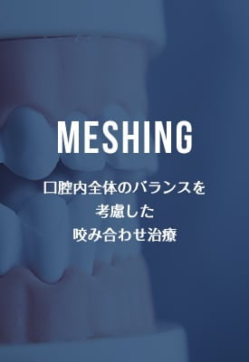 MESHING 口腔内全体のバランスを考慮した咬み合わせ治療